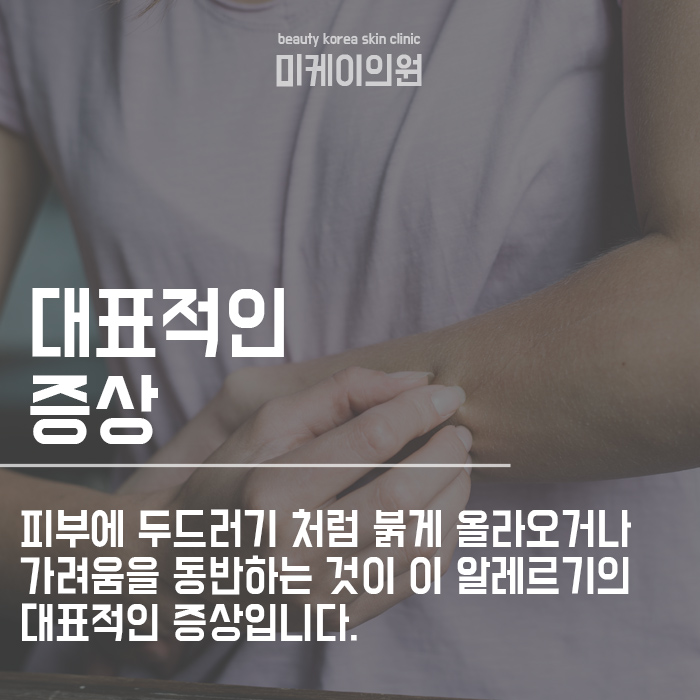 햇빛 알레르기 증상 및 원인 A~Z 알아보기 관련 이미지 2