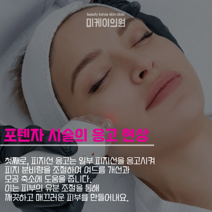 강남역포텐자 모든 피부 고민을 해결하는 레이저 관련 이미지 3