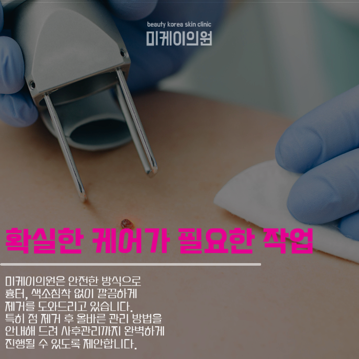 강남점제거 맑고 깨끗한 피부 관련 이미지 3