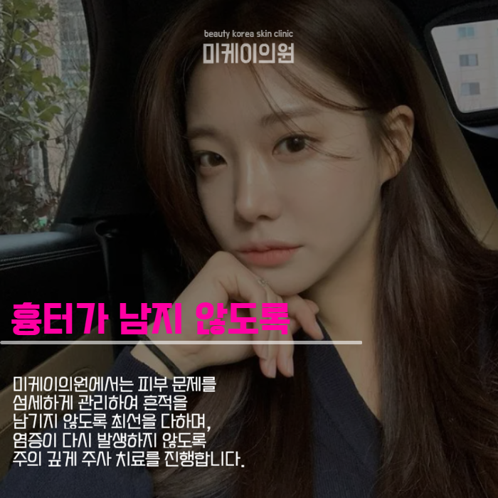 강남스킨케어피부과 맑은 피부를 유지하는 방법 관련 이미지 4