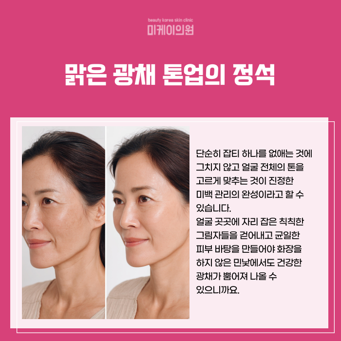 강남역 레이저토닝 기미 잡티 고민 관련 이미지 4