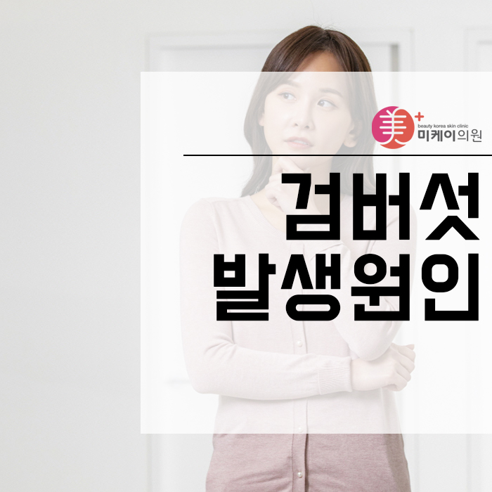검버섯발생원인 생활 속 예방법 알아봐요! 관련 이미지 1