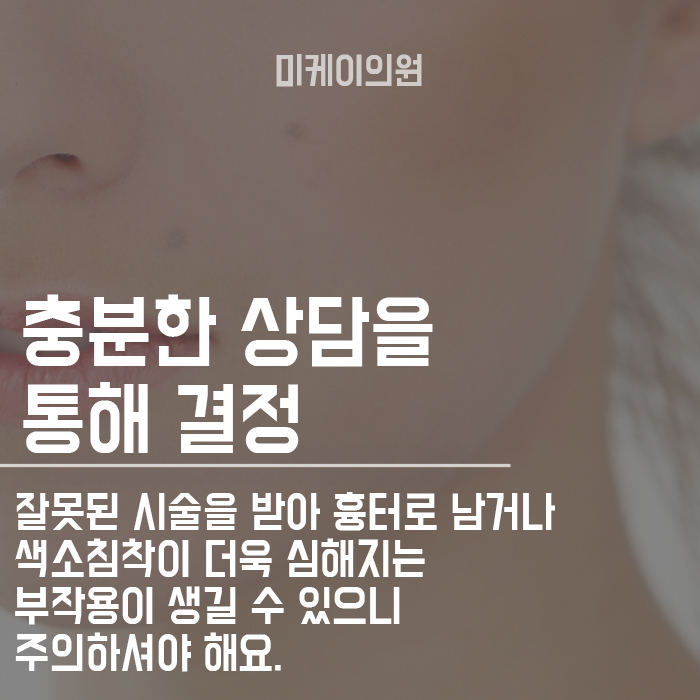 점제거 후 제대로 된 관리방법 관련 이미지 2