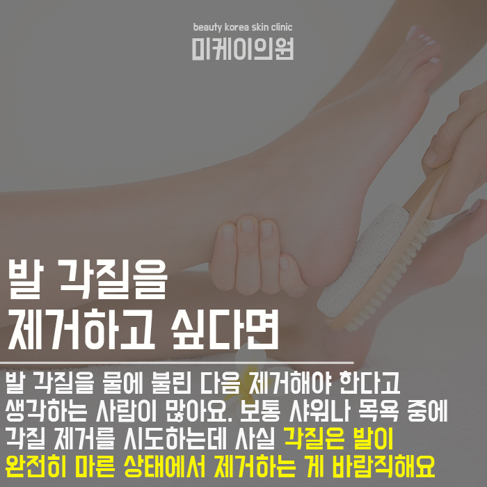 발뒤꿈치관리법 홈케어가 어렵다면 관련 이미지 2