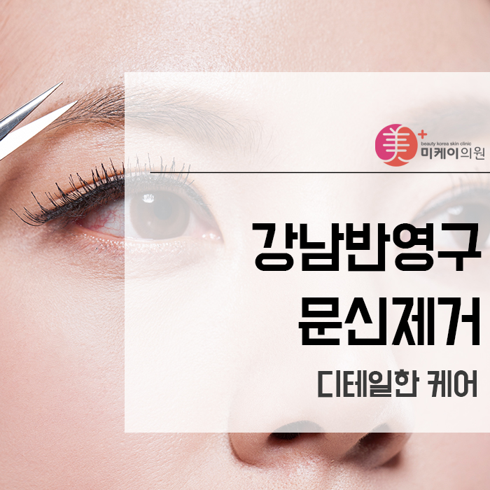 강남반영구문신제거 디테일한 케어 관련 이미지 1