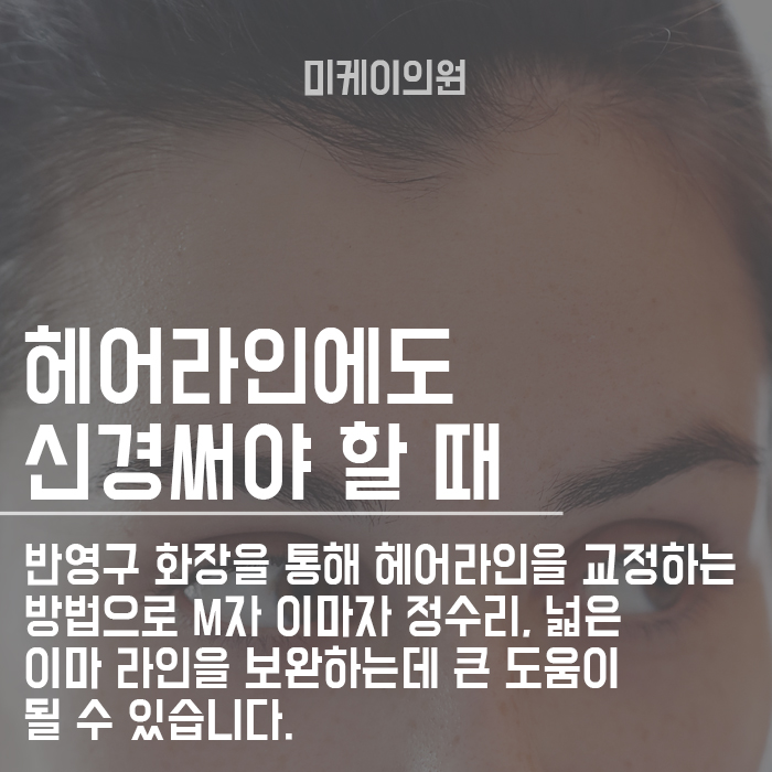 넓은이마 반영구 시술 지속관리와 방법 관련 이미지 2