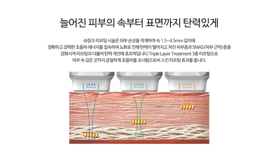 슈링크 맞은 후 관리 좀더 효과 보려면? 관련 이미지 4