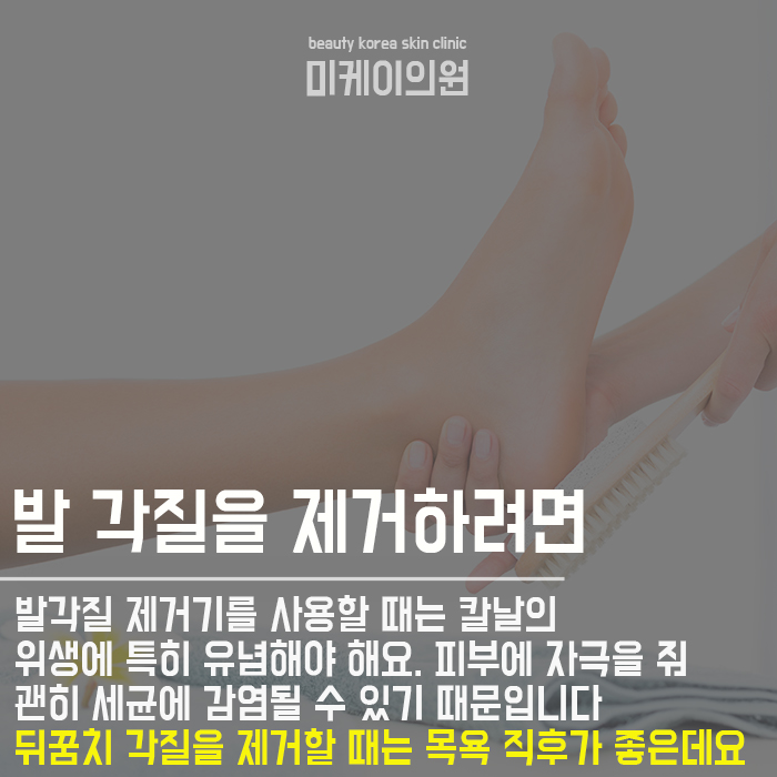 발각질관리하는팁 살펴보기 관련 이미지 3