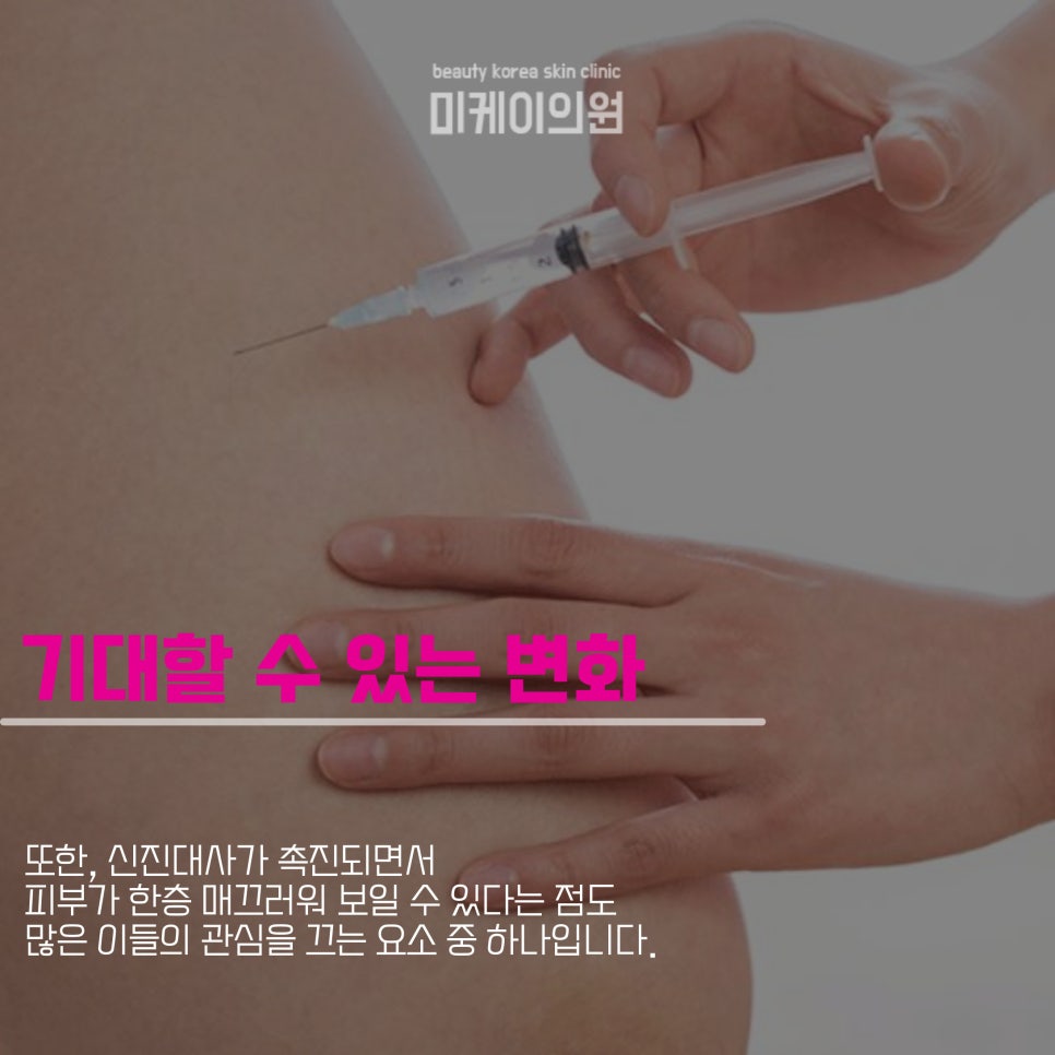 살빼는주사 카복시로 여름 준비 관련 이미지 3