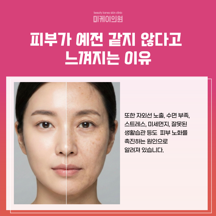 강남 리쥬란힐러 이벤트 지금 같은 날씨에 딱 관련 이미지 2
