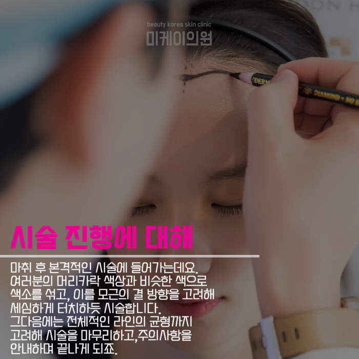 강남헤어라인 비어 보이거나 M자로 변했다면 관련 이미지 5