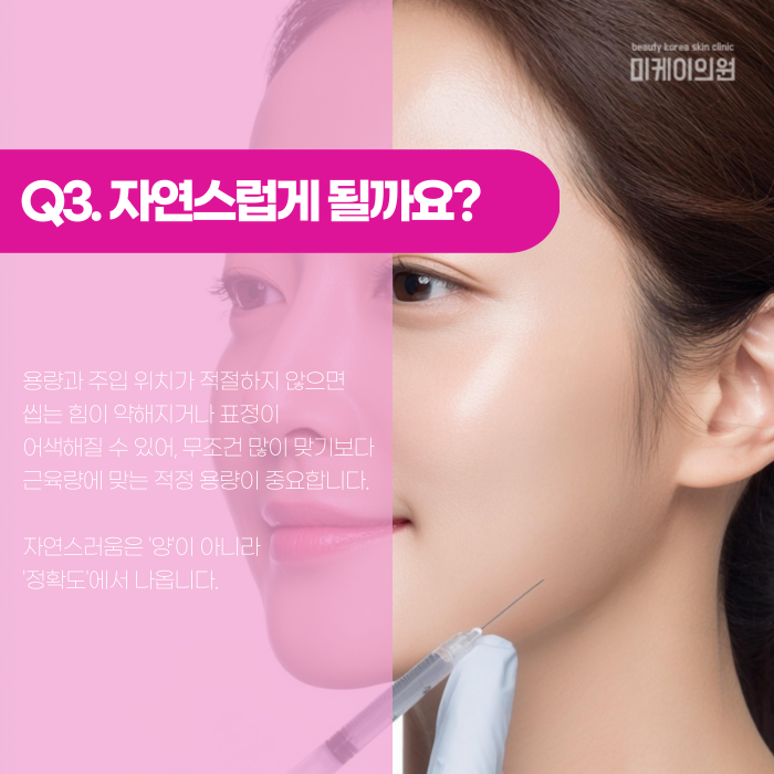 강남 사각턱보톡스, 자연스럽게 하려면? 관련 이미지 4