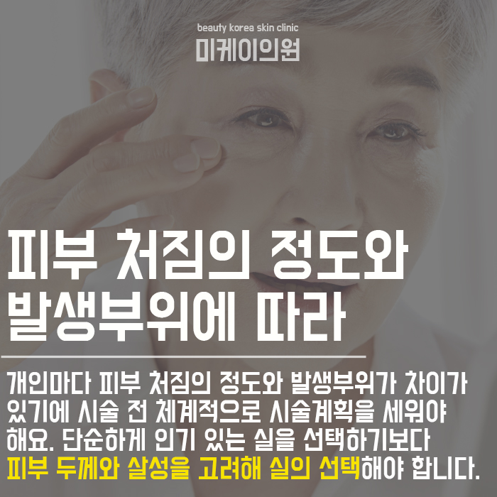 서초역실리프팅 달라진 라인 관련 이미지 8