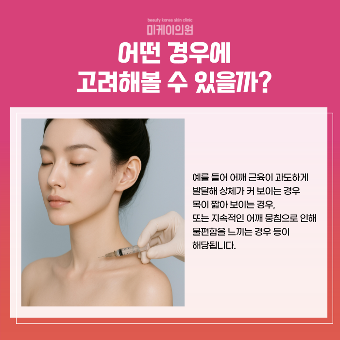 강남역 승모근보톡스 뭉친 어깨라인 개선 관련 이미지 3