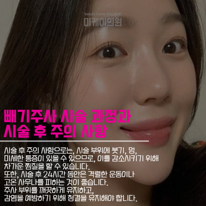 빼기주사 얼굴살 고민일때 관련 이미지 5