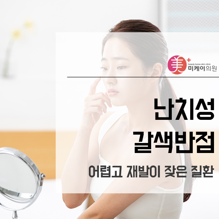 난치성갈색반점 어렵고 재발이 잦은 질환 관련 이미지 1