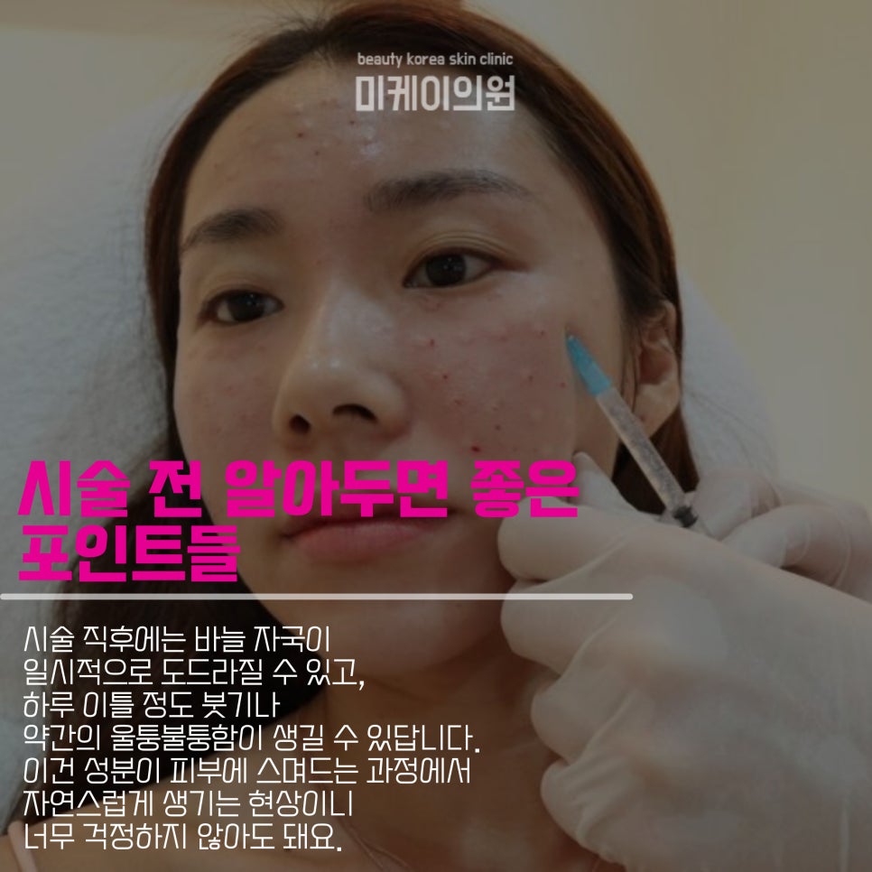 강남역 리쥬란힐러로 피부 속부터 관련 이미지 4