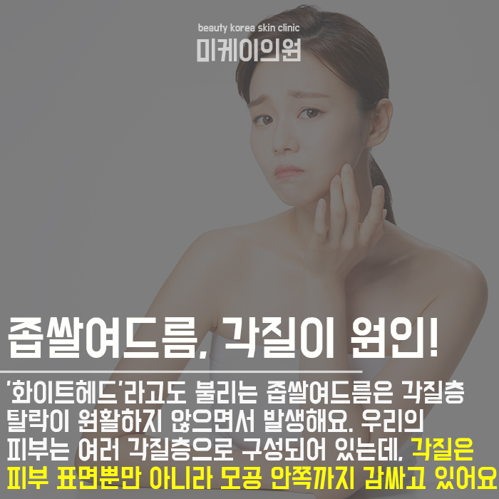 사춘기좁쌀여드름 원인 알고 없애요 관련 이미지 3