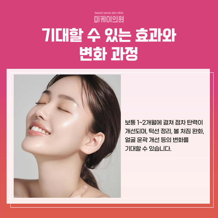 Gangnam Ulthera 600 Shots: Pain, Effects, and Duration image 3