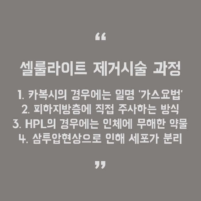 허벅지 셀룰라이트 제거시술 효과적인 것은 관련 이미지 5