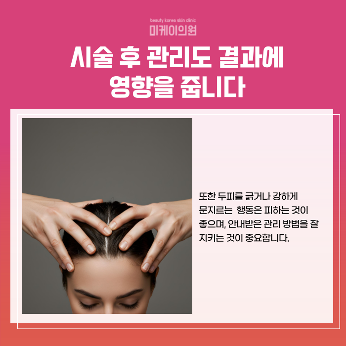 강남역 두피문신 자연스러운 빽빽한 헤어라인 관련 이미지 5