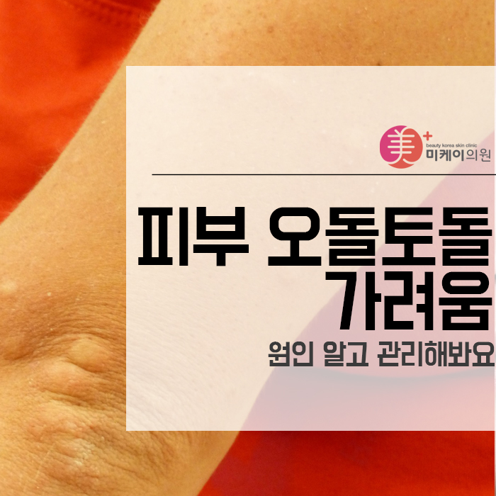피부 오돌토돌 가려움 원인 알고 관리해봐요 관련 이미지 1