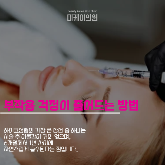 콧볼줄이는방법 자연스럽게 할 수 있어요 관련 이미지 3