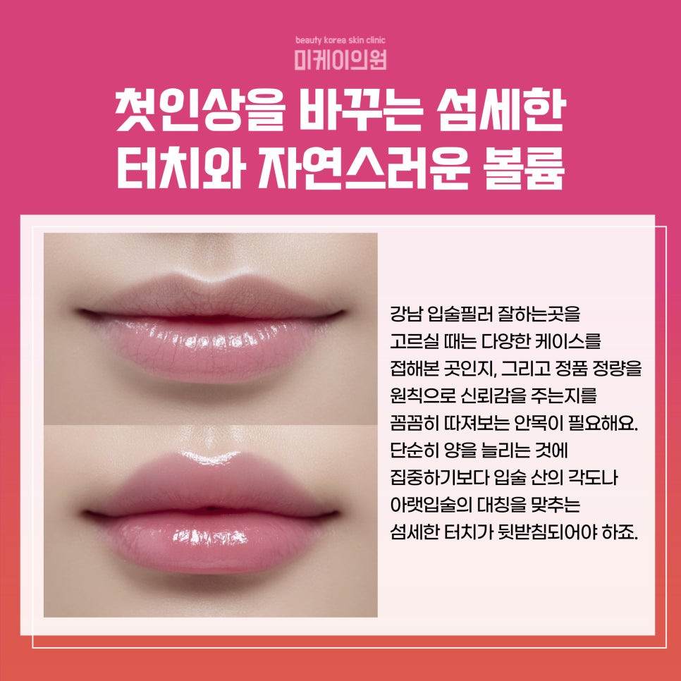 강남 입술필러 잘하는곳 맞춤 디자인 가능 관련 이미지 3