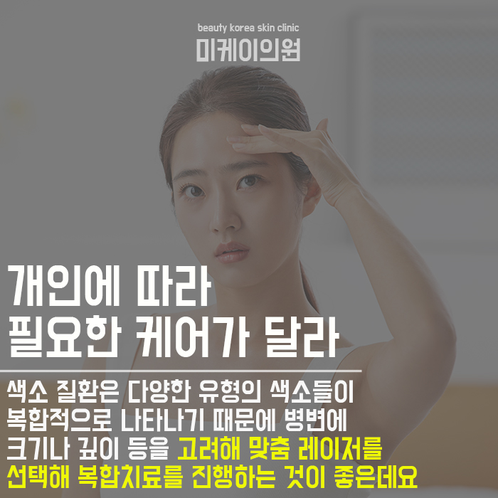 얼굴잡티제거시술 부담없이 시작해요 관련 이미지 2