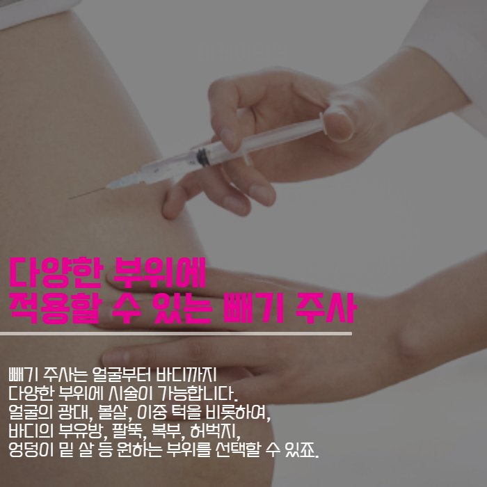강남역 지방분해주사 여름을 위한 몸매 관리 관련 이미지 5