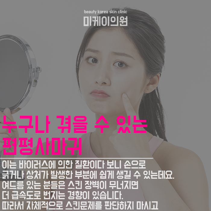 피부사마귀치료 사소한 증상도 무시할 수 없어요 관련 이미지 2