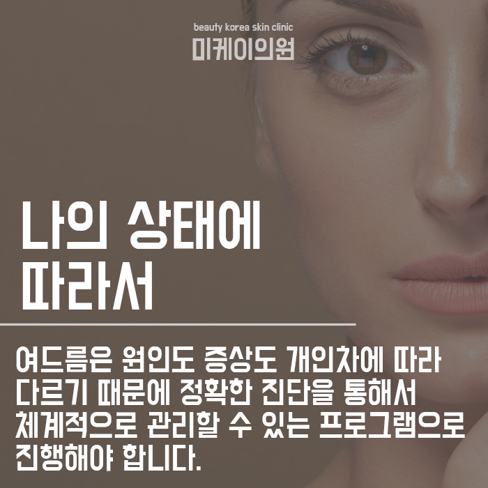 강남성인여드름 고민하지말고 관련 이미지 3