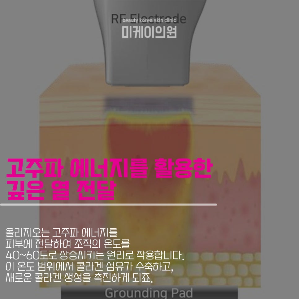 Improving Skin Elasticity with Oligio Near Gangnam Station image 2