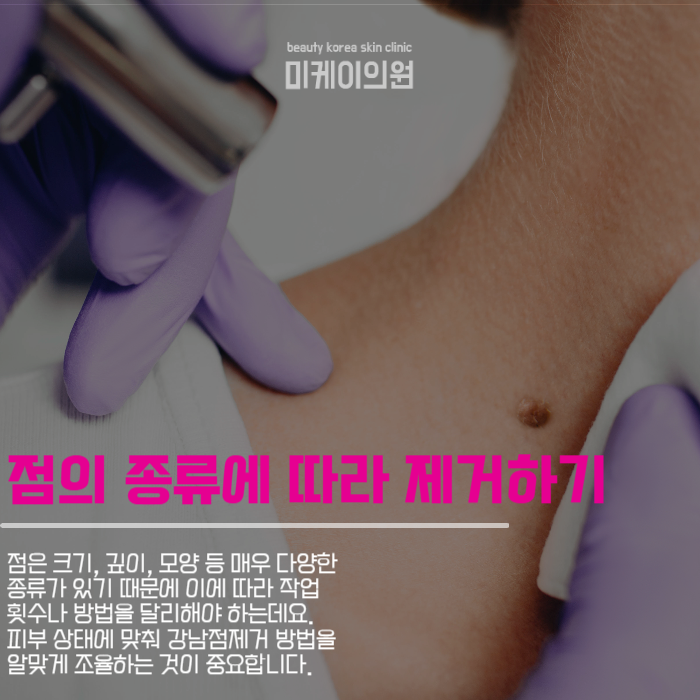 강남점제거 맑고 깨끗한 피부 관련 이미지 5