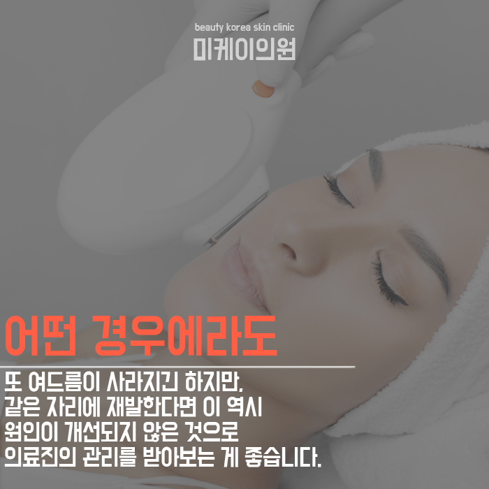 강남역여드름의원 고민에서 해방 관련 이미지 5