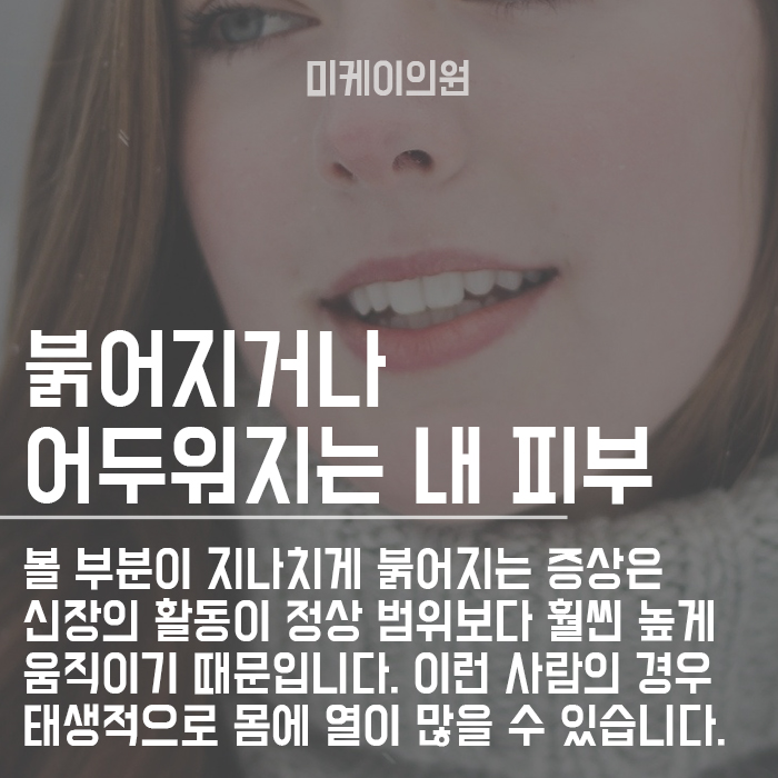 피부톤으로 보는 건강신호 주의하기 관련 이미지 3
