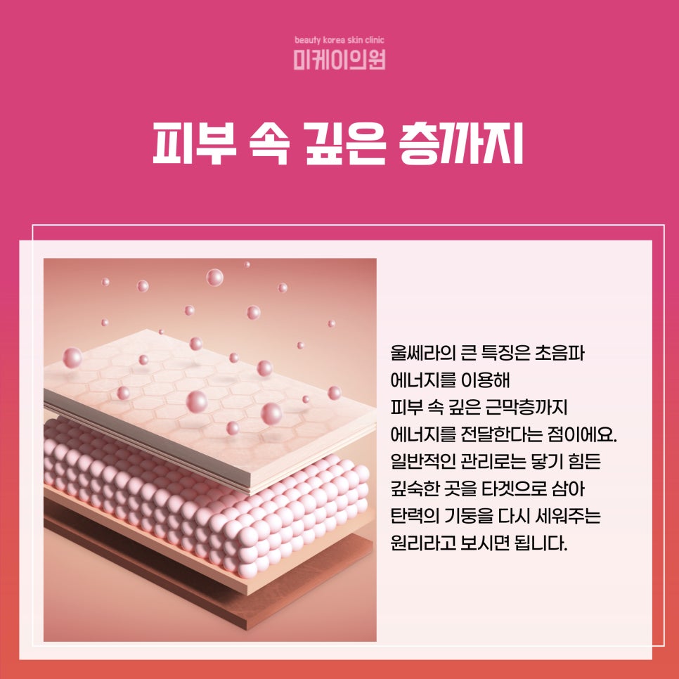Where to Get Ulthera Done Well at a Dermatology Clinic Near Gangnam Station image 2