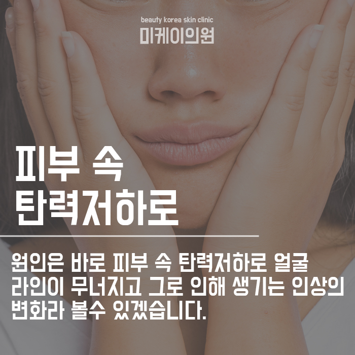 강남역실리프팅 안전하게 효과적으로 관련 이미지 2