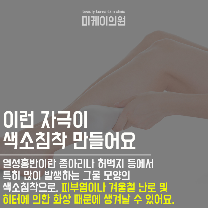 다리색소침착레이저 안심하고 받아보세요 관련 이미지 2