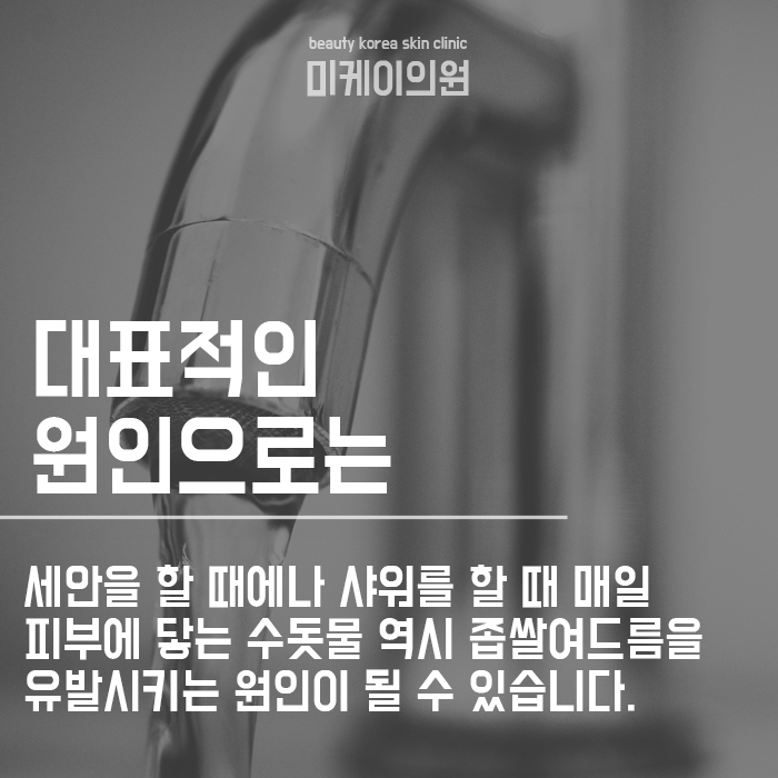 서초구피부관리 좁쌀여드름원인 및 관리법 초기부터 관련 이미지 2