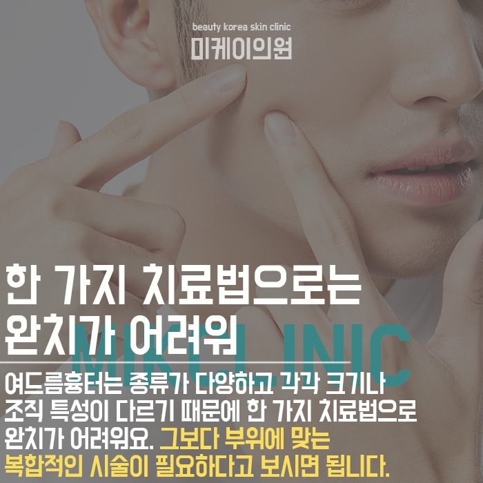 서초여드름흉터 피부가 지저분해 보이지 않도록 관련 이미지 2
