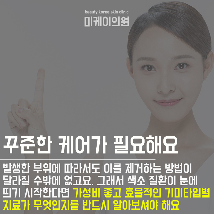 기미타입별치료 많은 분들이 궁금해하시는 정보! 관련 이미지 3