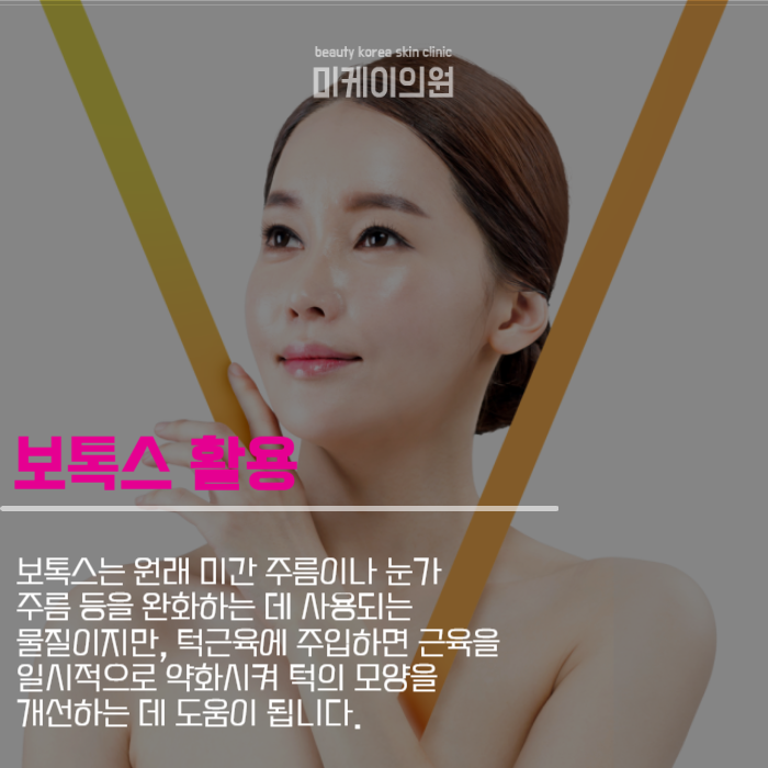 사각턱보톡스 활용하여 아름다운 얼굴을 관련 이미지 2