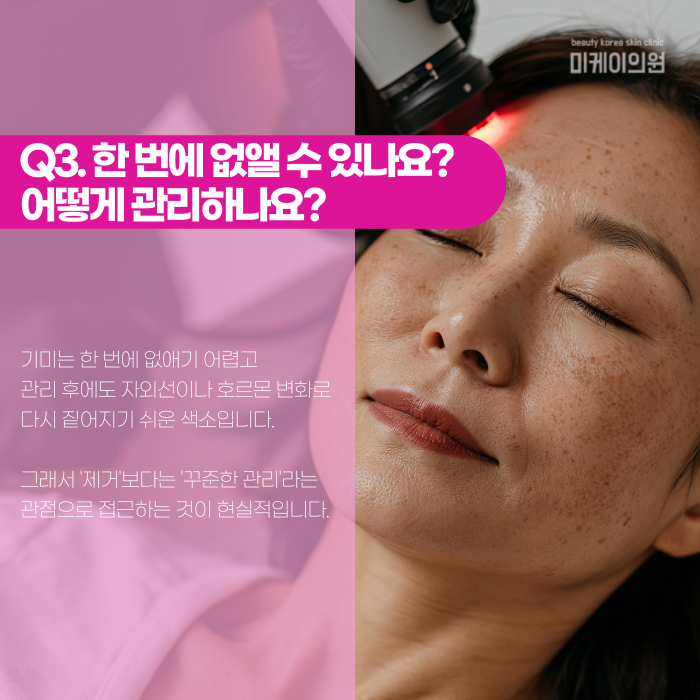 Gangnam Melasma Dermatology Clinic: Why Does It Keep Coming Back? image 4