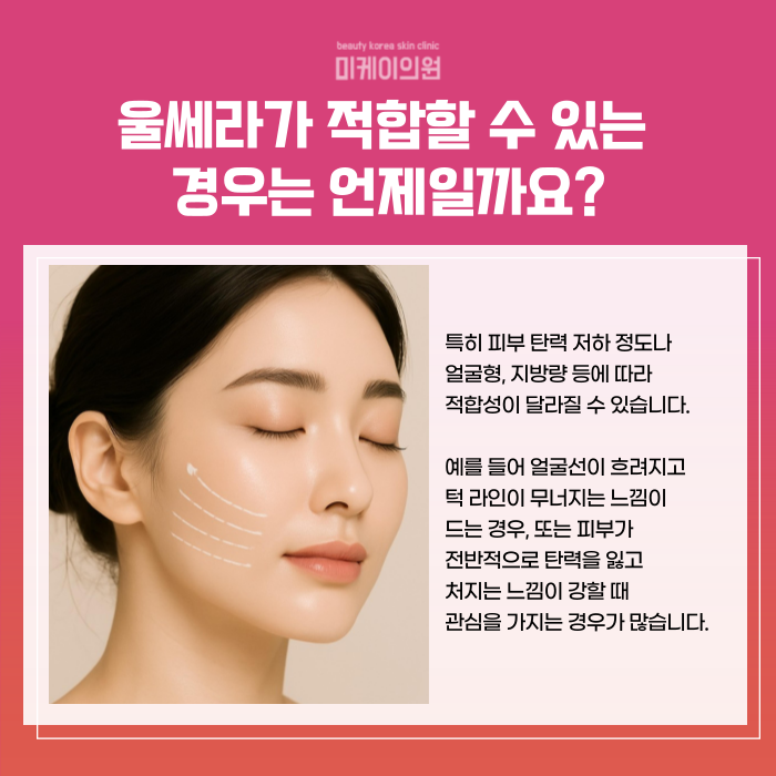 Tips You Should Know Before a Gangnam Station Ulthera Event Procedure image 3