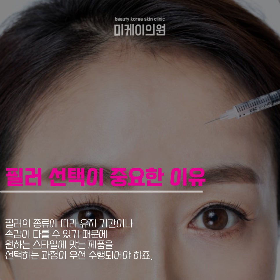 What Causes Swelling After Forehead Filler and How to Reduce It image 2