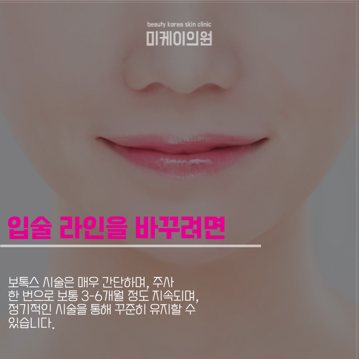 강남역 입꼬리필러로 매력적인 인상 만들기 관련 이미지 3