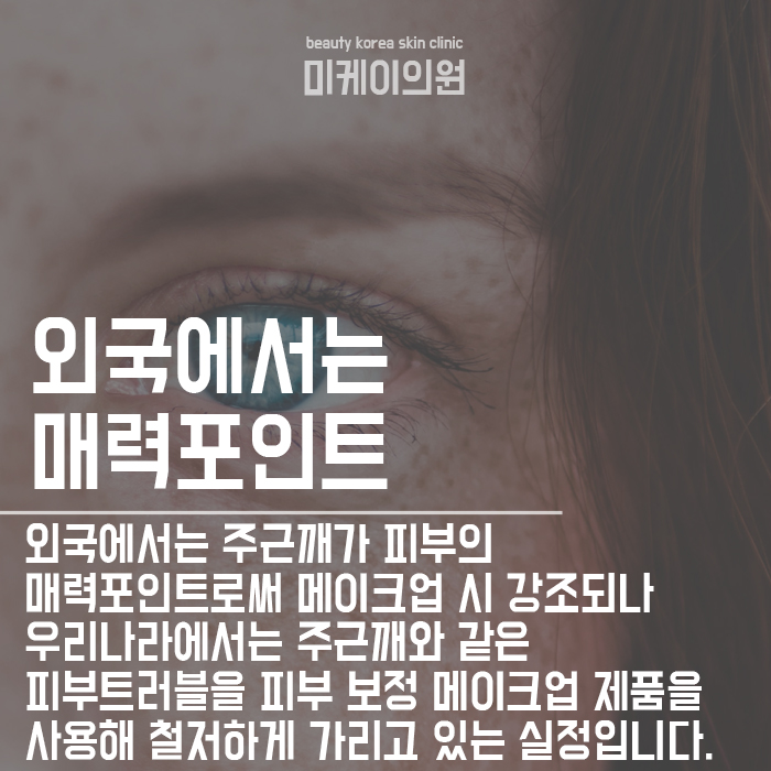 서초구피부과 주근깨 생기는 이유 및 없애는 법 관련 이미지 3