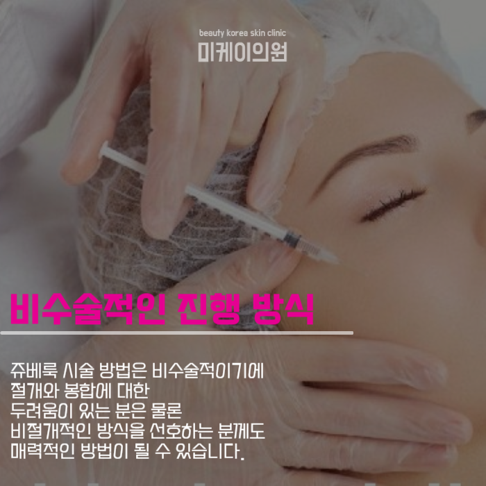 쥬베룩 시술 방법 가느다란 바늘이라면 관련 이미지 2