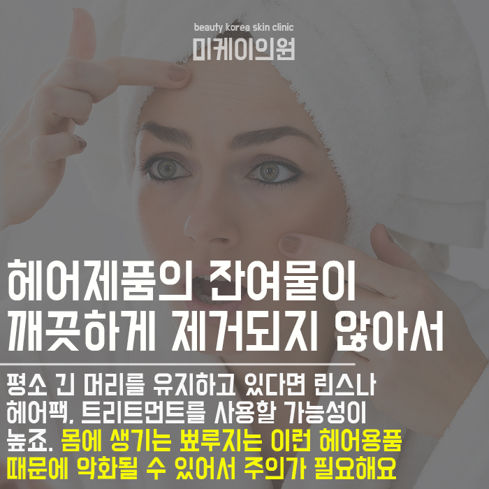 갑자기 생긴 가슴여드름 해결하는방법 따라해보세요 관련 이미지 2